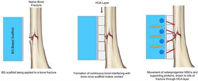 Ion—modified optimization of smart scaffolds in bone tissue regeneration